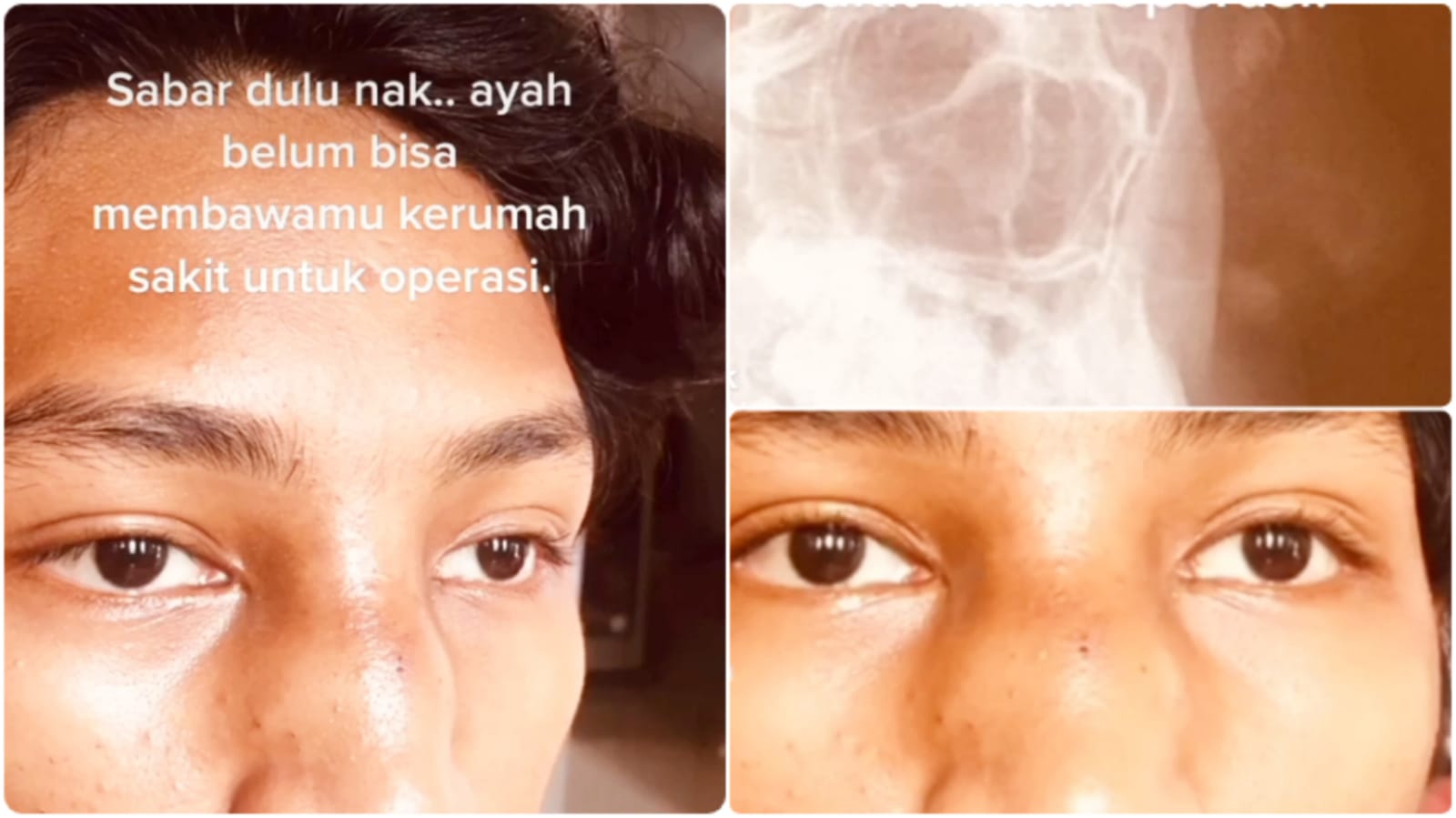 operasi pesepakbola muda